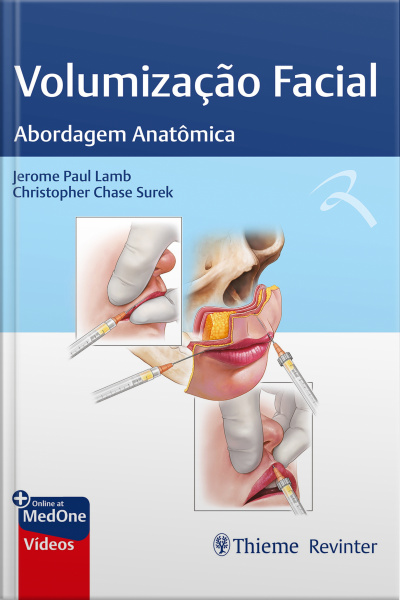 Volumização Facial: Abordagem Anatômica