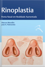 Rinoplastia: Ponta Nasal Em Realidade Aumentada