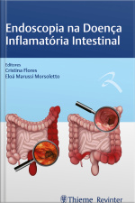 Endoscopia Na Doença Inflamatória Intestinal