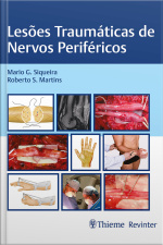 Lesões Traumáticas De Nervos Periféricos