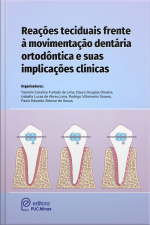 Reações Teciduais Frente À Movimentação Dentária Ortodóntica E Suas Implicações Clínicas