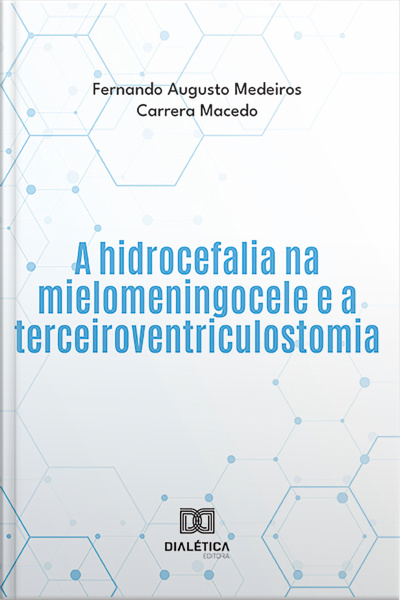 A Hidrocefalia Na Mielomeningocele E A Terceiroventriculostomia