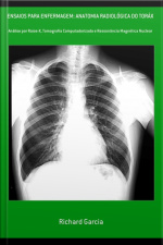 Ensaios Para Enfermagem: Anatomia Radiológica Do Toráx