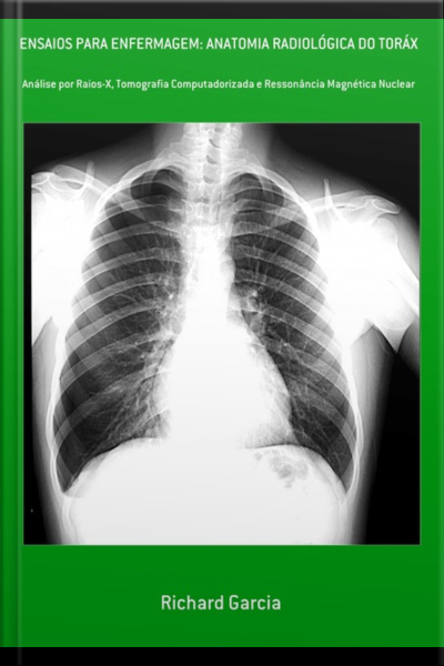 Ensaios Para Enfermagem: Anatomia Radiológica Do Toráx