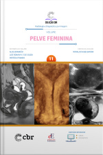 Coleção Cbr Volume 11 Pelve Feminina: Coleção Cbr Radiologia E Diagnóstico Por Imagem