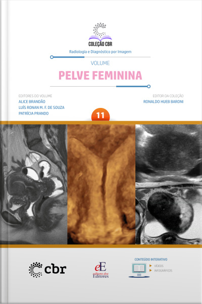 Coleção Cbr Volume 11 Pelve Feminina: Coleção Cbr Radiologia E Diagnóstico Por Imagem
