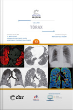 Coleção Cbr Volume 13 - Tórax