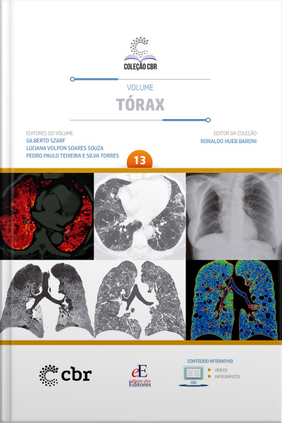 Coleção Cbr Volume 13 - Tórax