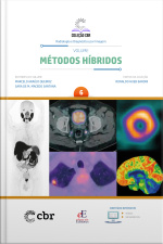 Coleção Cbr Volume 6 - Métodos Híbridos