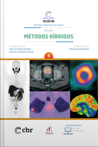 Coleção Cbr Volume 6 - Métodos Híbridos