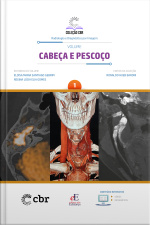 Coleção Cbr Volume 1 - Cabeça E Pescoço : Coleção Cbr - Radiologia E Diagnóstico Por Imagem