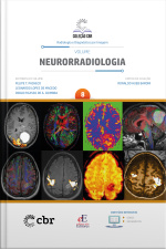 Coleção Cbr Volume 8 - Neurorradiologia