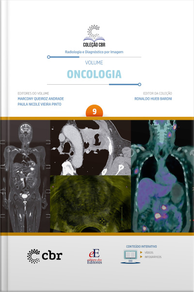 Coleção Cbr Volume 9 - Oncologia