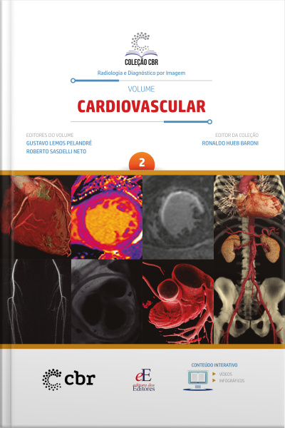 Coleção Cbr Volume 2 - Cardiovascular