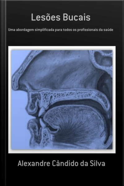 Lesões Bucais