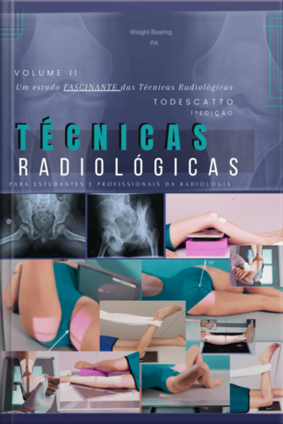 Técnicas Radiológicas Volume Ii