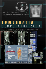 Livro De Tomografia Computadorizada