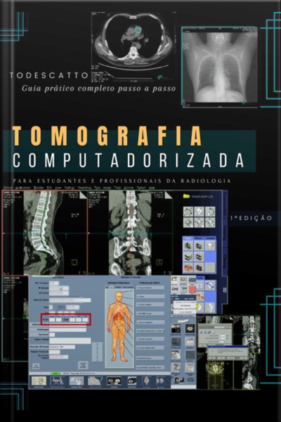 Livro De Tomografia Computadorizada