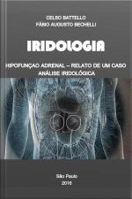 Iridologia - Hipofunção Adrenal: Relato De Um Caso - Análise Iridológica