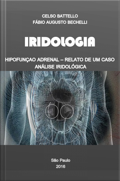 Iridologia - Hipofunção Adrenal: Relato De Um Caso - Análise Iridológica